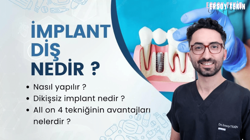 implant diş nedir