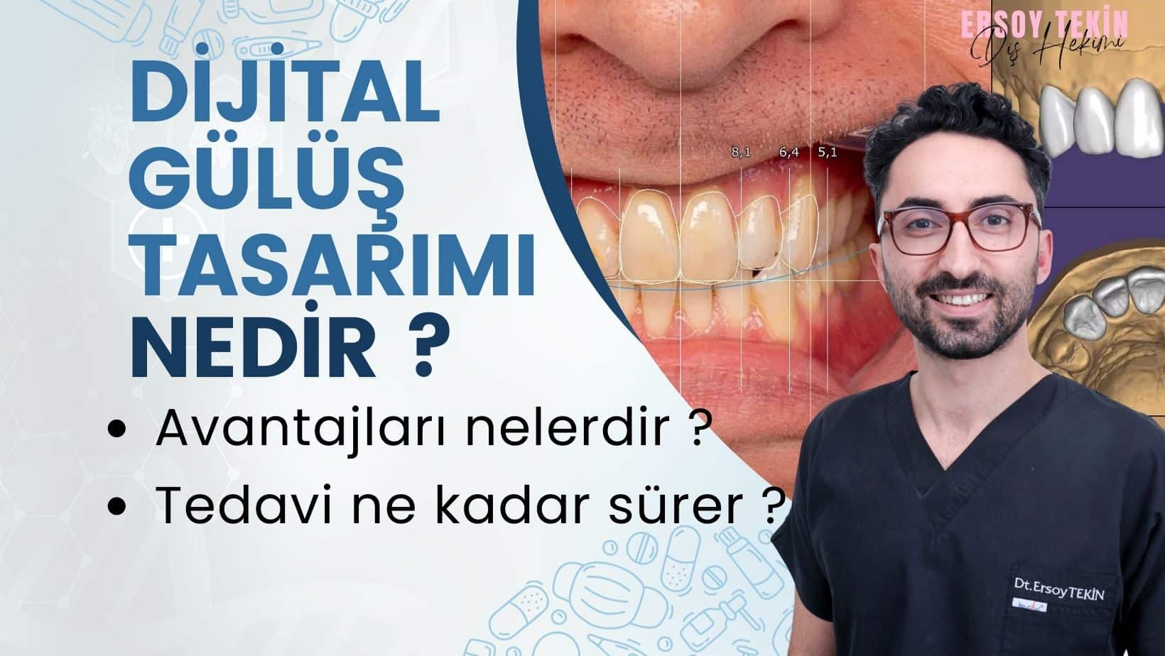 dijital gülüş tasarımı