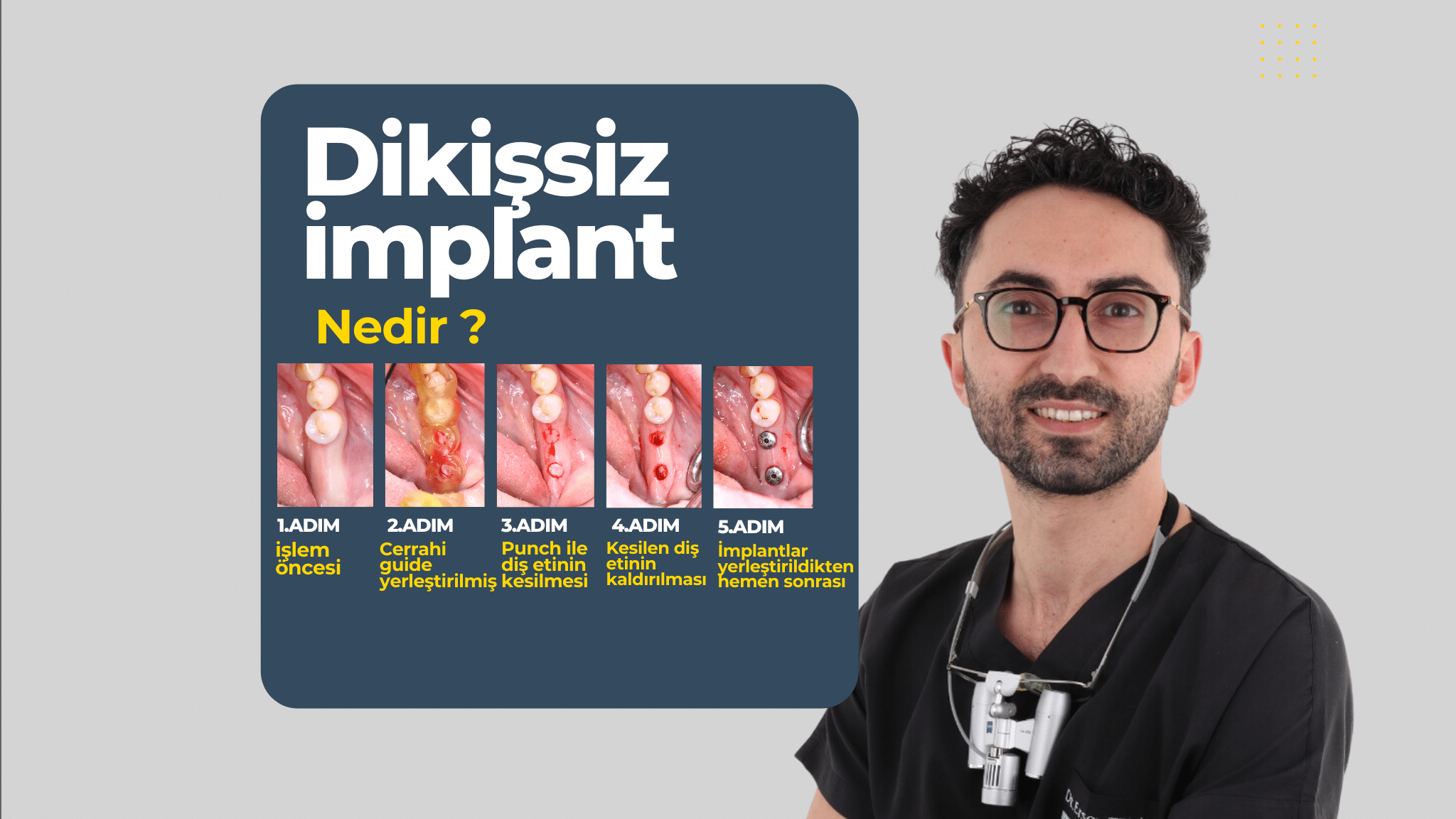 yerli implant fiyatları 2024
