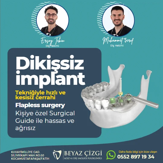 dikişsiz implant fiyatları 2023