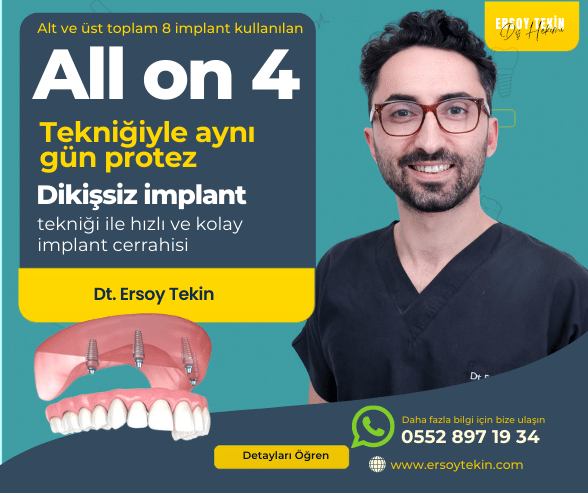 all-on-four-implant-fiyatlari 2025