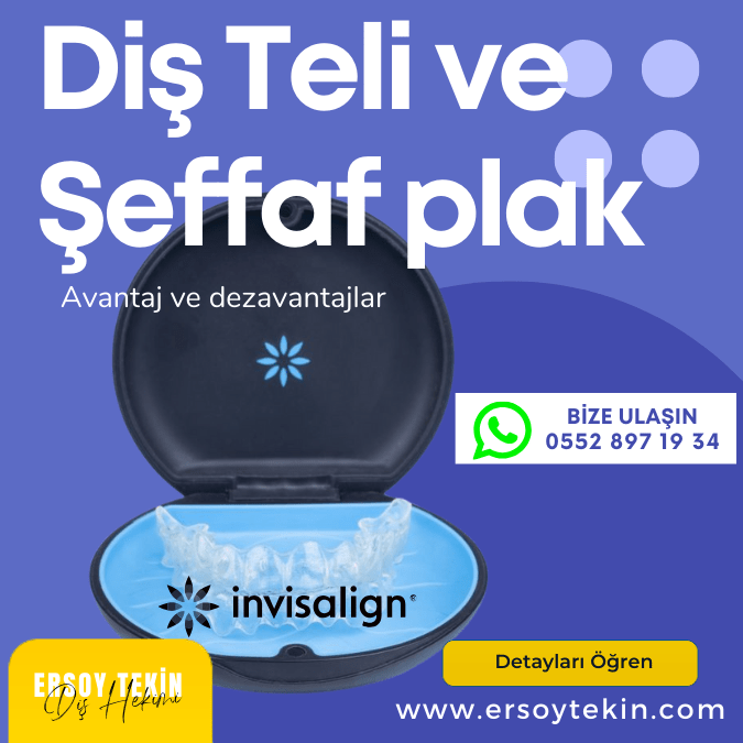 Diş Teli Fiyatları 2025